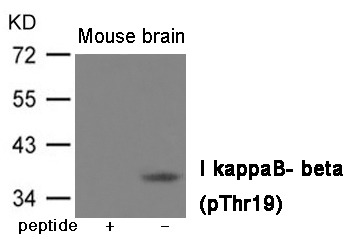 Anti-Phospho-IkappaB- beta (Thr19) Polyclonal Antibody