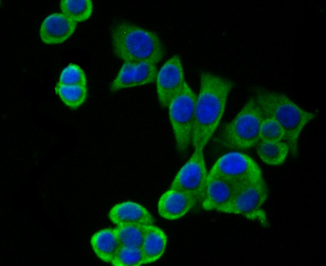Anti-hUPF1 Antibody (4P615)
