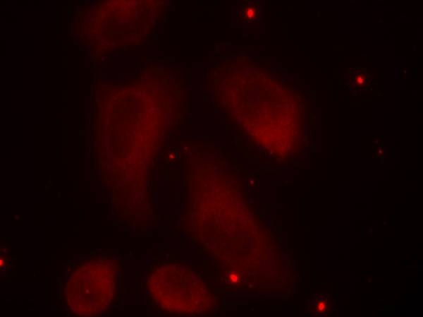 Anti-Phospho-LIMK1 (Thr508) Polyclonal Antibody