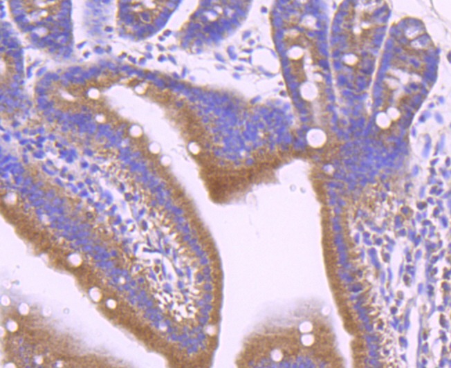 Anti-LEPR Antibody (5J993)
