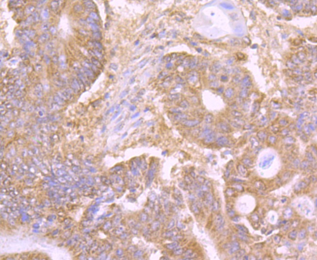 Anti-LY75 Antibody (7T586)