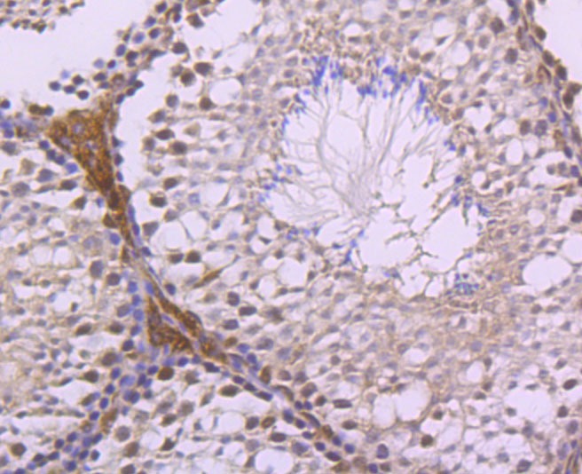 Anti-LXR-alpha Antibody (5E494)