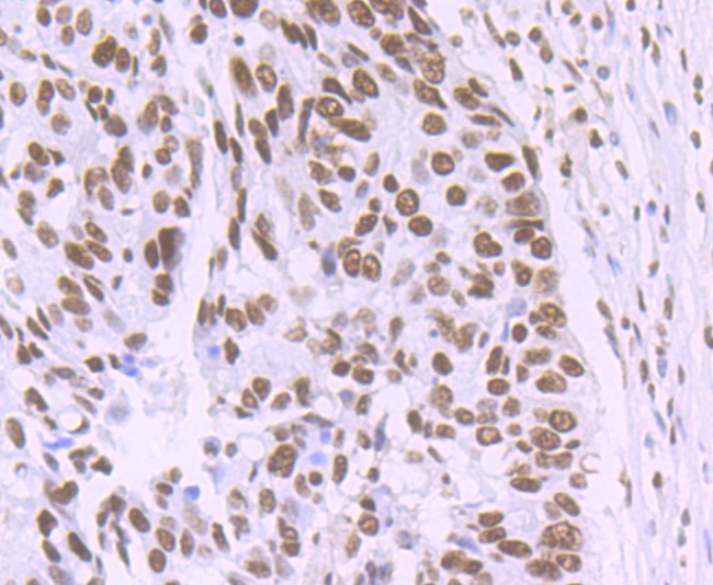 Anti-Matrin 3 Antibody (7P173)