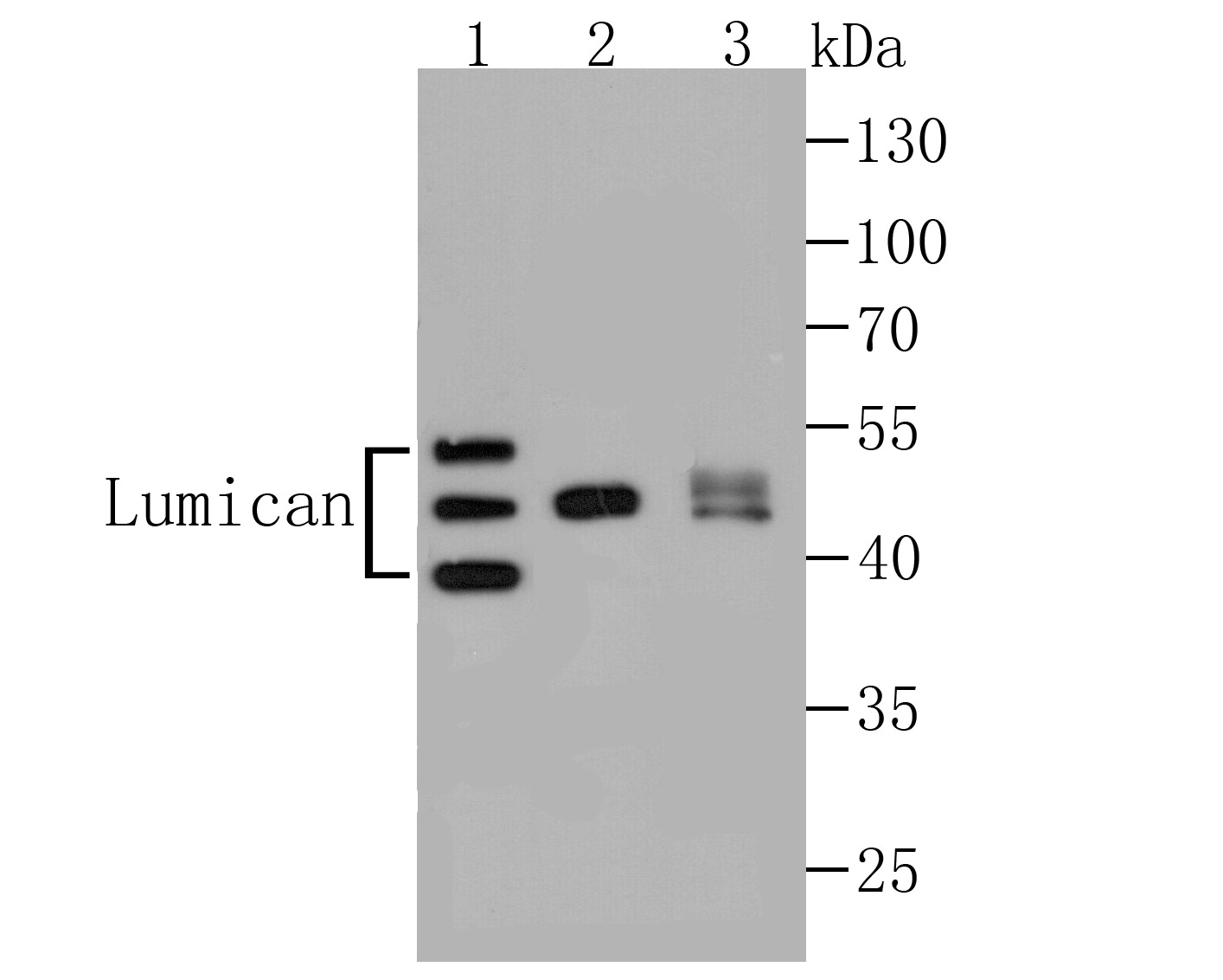 Anti-Lumican Antibody (9X464)