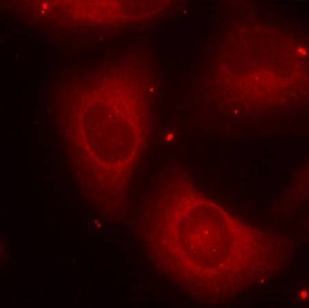 Anti-Phospho-LIMK2 (Thr505) Polyclonal Antibody