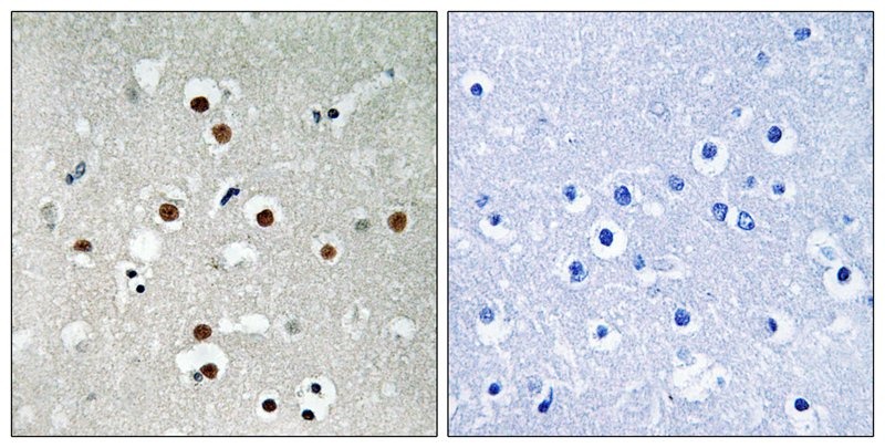 Anti-Phospho-MEF2C (Ser396) Polyclonal Antibody