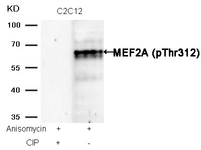 Anti-Phospho-MEF2A (Thr312) Polyclonal Antibody