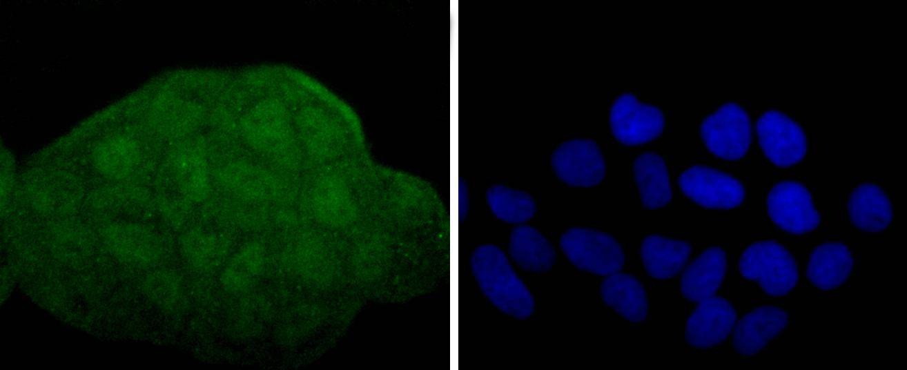 Anti-MAP2K3/MAP2K6 Antibody (7F635)
