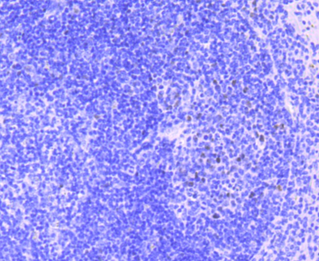 Anti-MEF2A Antibody (5F773)