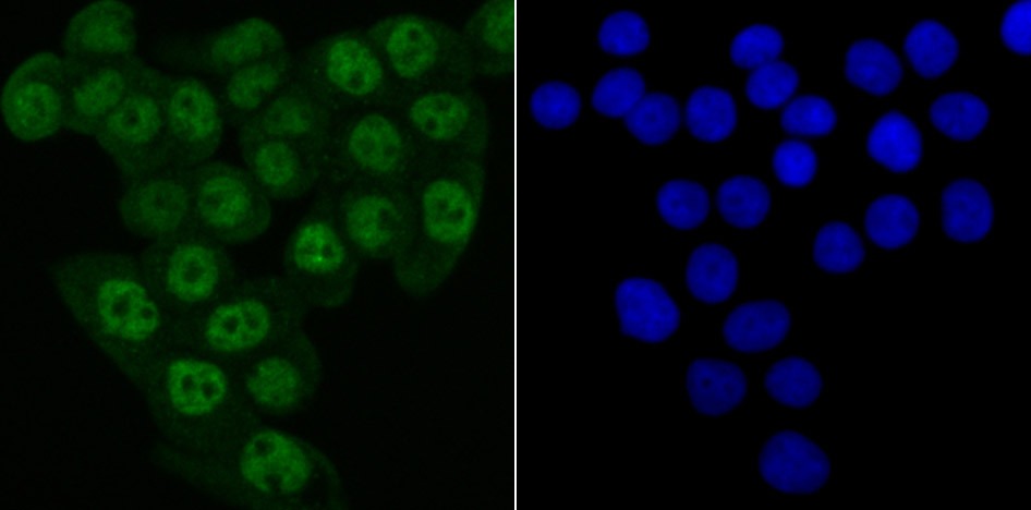 Anti-Matrin 3 Antibody (7P173)