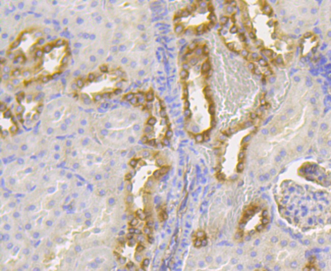 Anti-Lumican Antibody (9X464)