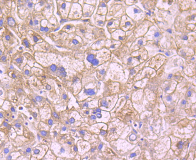 Anti-LEPR Antibody (5J993)