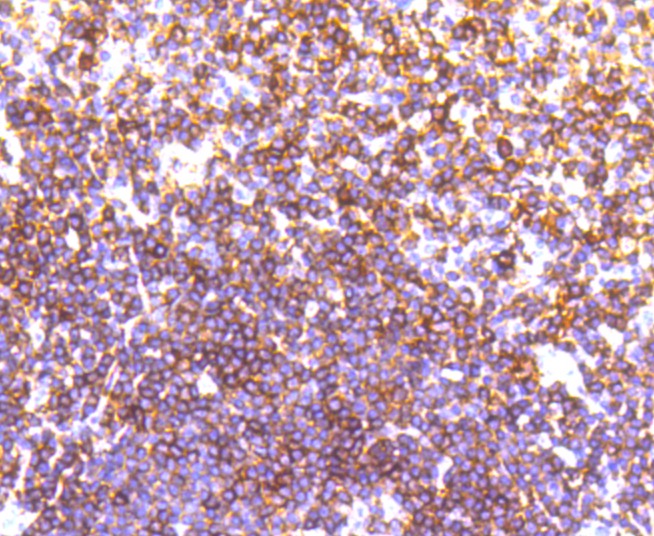 Anti-LSP1 Antibody (1E727)