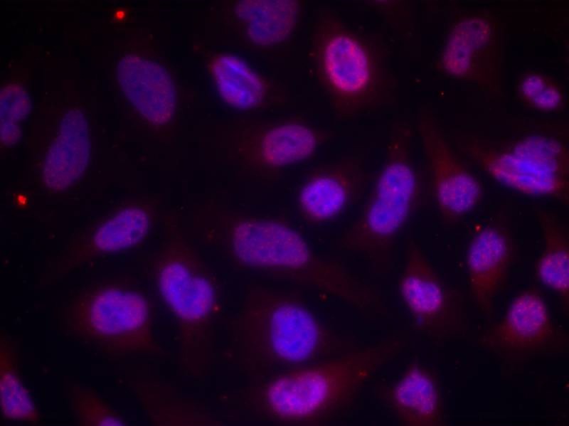 Anti-Phospho-MEF2A (Thr312) Polyclonal Antibody