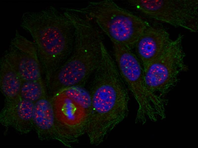 Anti-Phospho-MEF2A (Thr319) Polyclonal Antibody