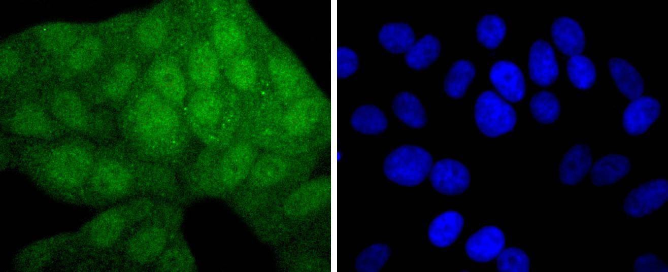 Anti-MAP2K3/MAP2K6 Antibody (7F635)