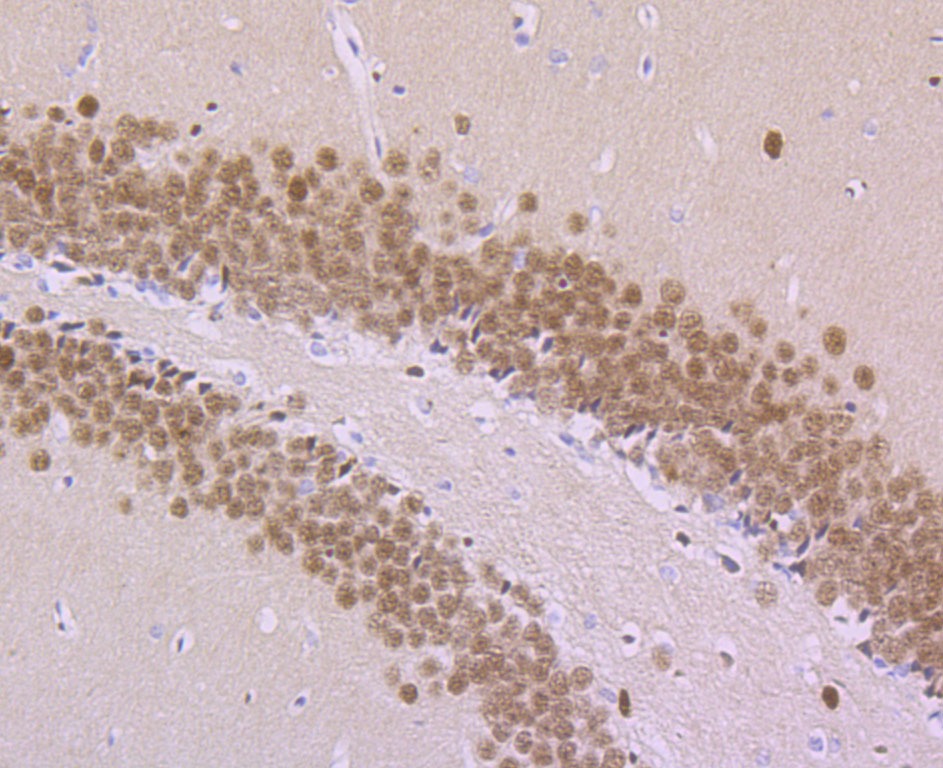 Anti-MEF2A Antibody (5F773)