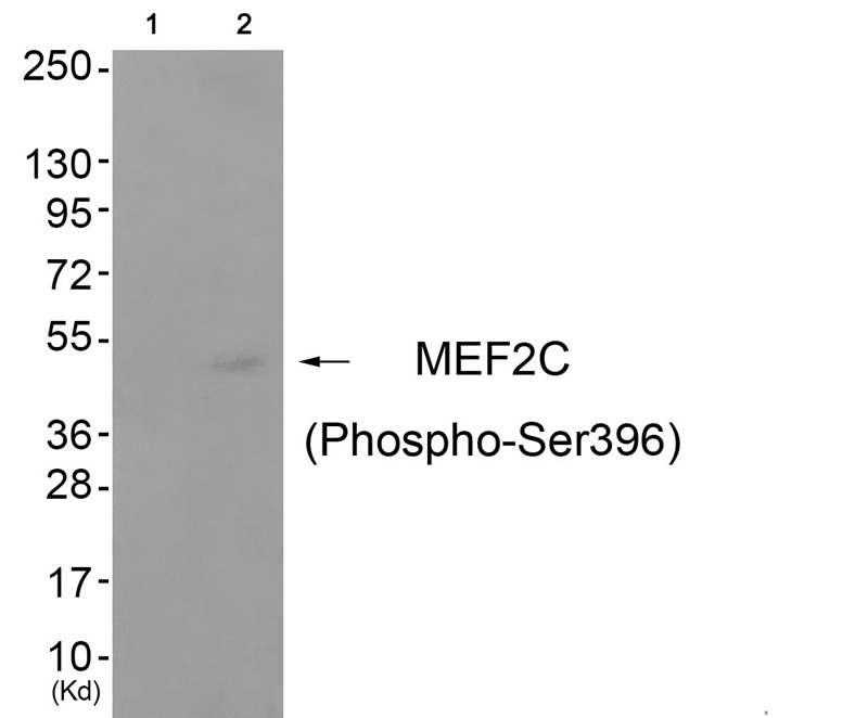 Anti-Phospho-MEF2C (Ser396) Polyclonal Antibody