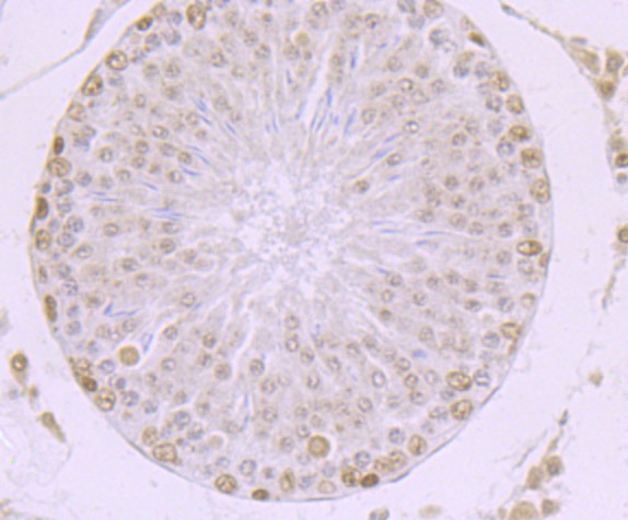 Anti-MBD3 Antibody (8O286)