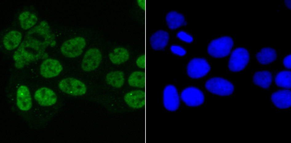 Anti-Matrin 3 Antibody (7P173)