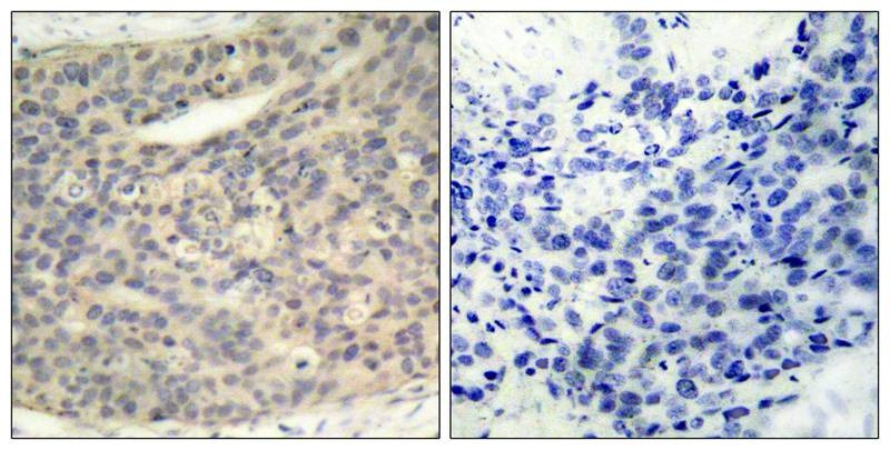 Anti-Phospho-LIMK1 (Thr508) Polyclonal Antibody