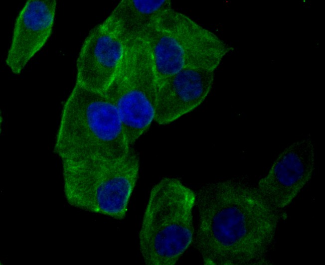 Anti-Lumican Antibody (9X464)