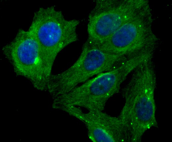 Anti-Lumican Antibody (9X464)