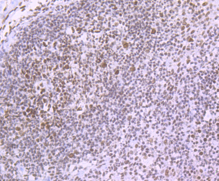 Anti-Matrin 3 Antibody (7P173)