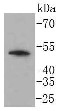 Anti-LSP1 Antibody (1E727)
