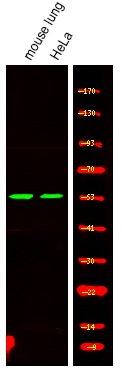 Anti-Phospho-MAZ (Thr72) Polyclonal Antibody