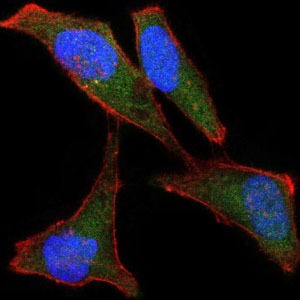 Anti-BPIFB1 Antibody (7V287)