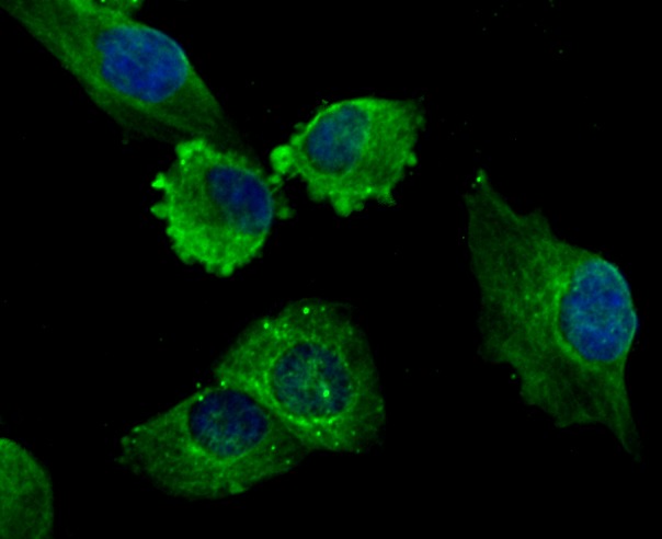 Anti-LOX Antibody (2A200)