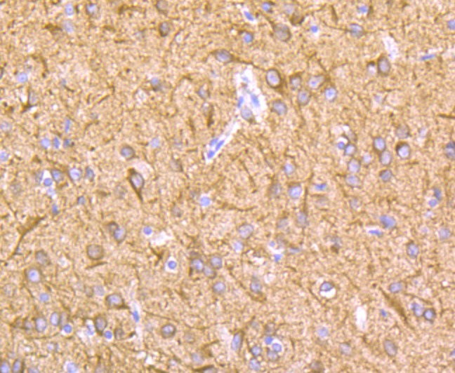 Anti-LOXL2 Antibody (5D796)