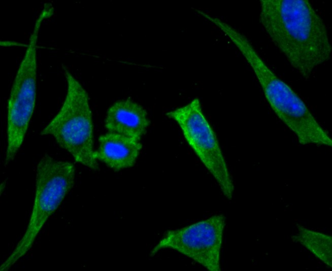 Anti-LOX Antibody (2A200)