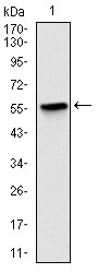 Anti-BPIFB1 Antibody (7V287)