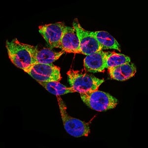 Anti-LPA Antibody (1M439)