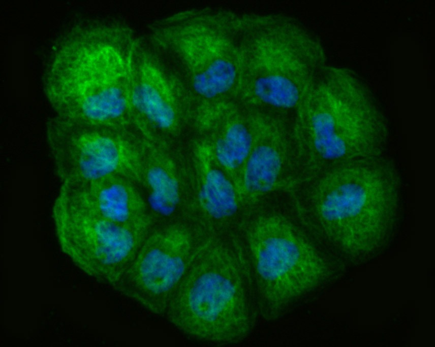 Anti-LOXL2 Antibody (5D796)