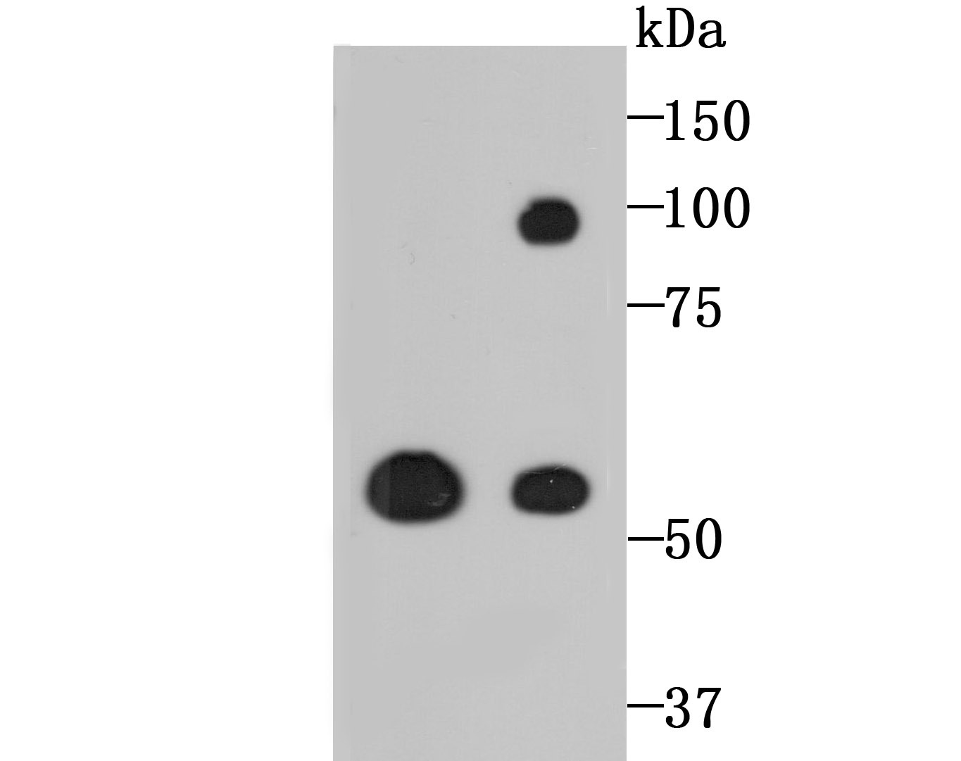 Anti-LOXL2 Antibody (5D796)