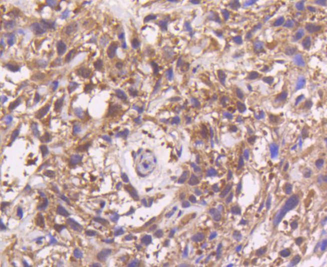 Anti-MAP2K3 Antibody (1S917)