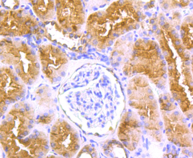 Anti-LOX Antibody (2A200)