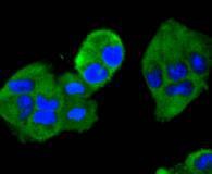 Anti-MEK2 Antibody (9Y802)