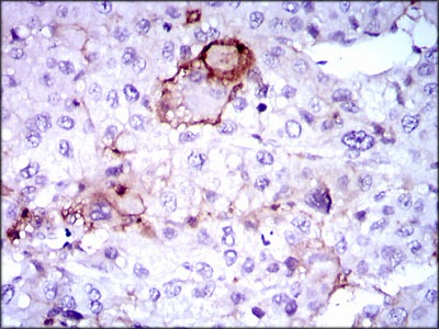Anti-LPA Antibody (1M439)