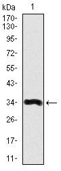 Anti-LPA Antibody (1M439)