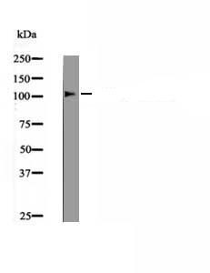 Anti-Phospho-LLGL2 (Tyr499) Polyclonal Antibody