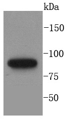 Anti-MLH1 Antibody (9P46)