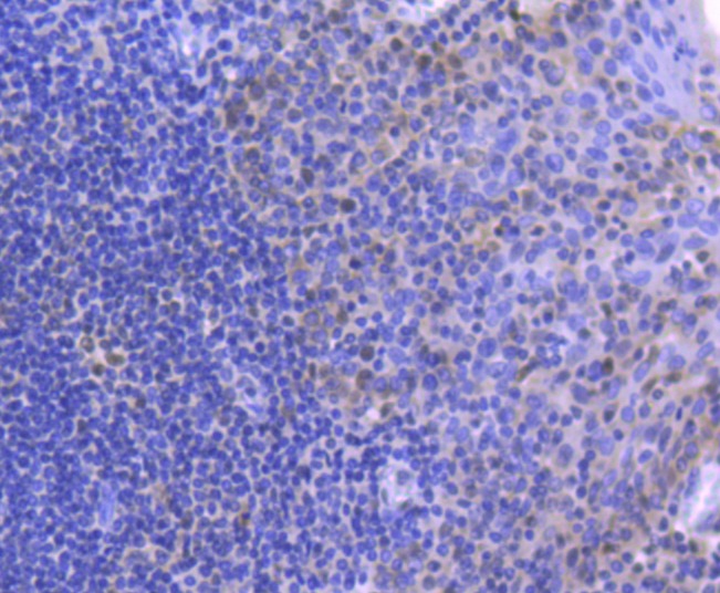 Anti-MLH1 Antibody (9P46)