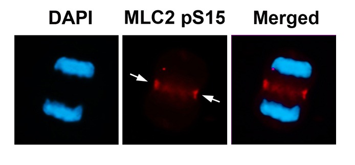 Anti-Phospho-MLC2 (Ser15) Polyclonal Antibody