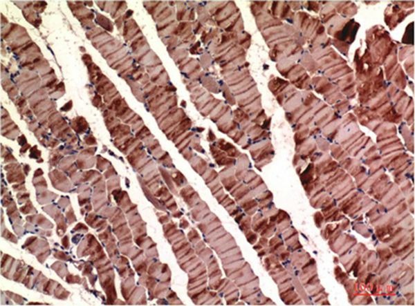 Anti-ACTA1 Antibody (5V392)