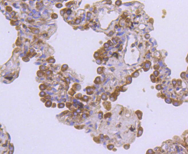 Anti-HGFR/c-Met Antibody (4N790)