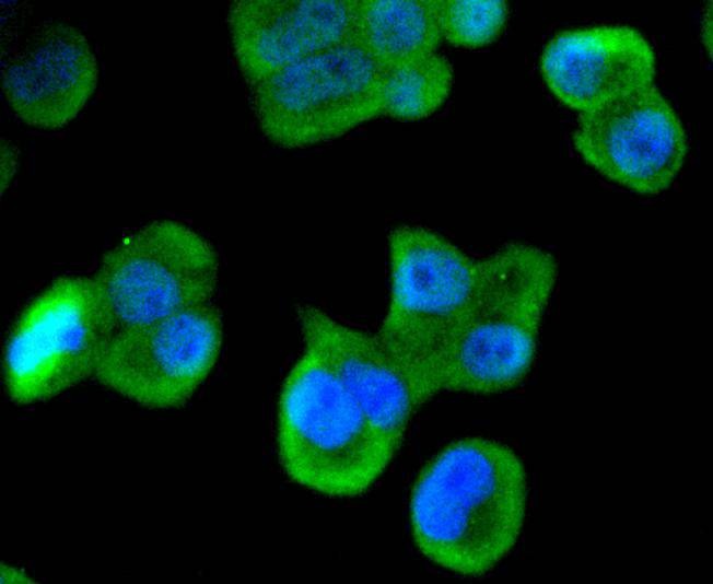 Anti-Musashi 1 Antibody (3I437)